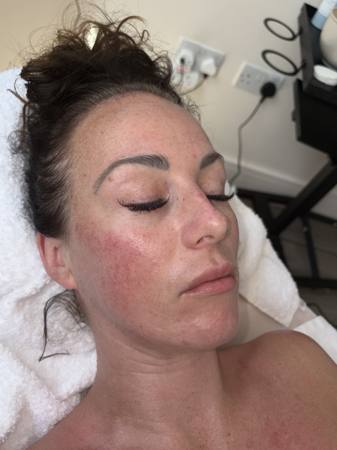 Lash extension treatment result